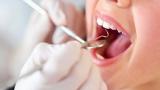 Lấy cao răng có thực sự làm trắng răng?
