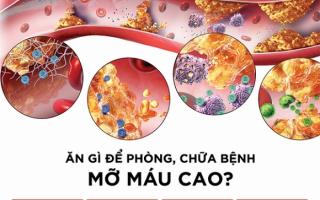 Không chỉ người béo, gầy cũng có thể bị mỡ máu cao: 6 thực phẩm nên ăn để 'tiêu' mỡ nhanh