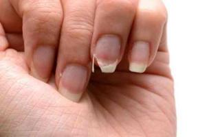 5 dấu hiệu tố cáo cơ thể đang bị thiếu hụt canxi nghiêm trọng, xương càng ngày càng giòn, dễ gãy