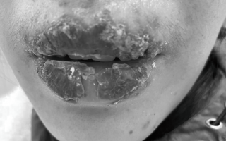 Nữ sinh 15 tuổi ‘nát’ môi vì theo chị đi xăm