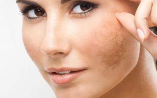 Ghim ngay những tips đơn giản cấp cứu làn da khô, giúp da trở nên căng mướt
