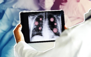 Viêm phổi: Cách phòng ngừa và điều trị hiệu quả với Bảo Phế Vương