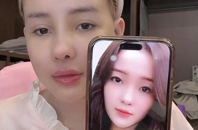 Tình trạng hiện tại của Ngân 98 sau khi tiếp tục dao kéo